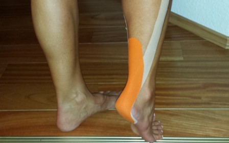 Achilles-sérülés – oly könnyedén elkerülhető!